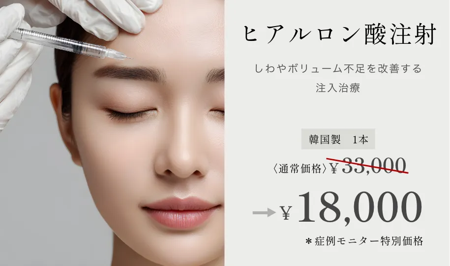 ヒアルロン酸注射 韓国製1本 ¥32,000→¥18,000~ ※症例モニター特別価格