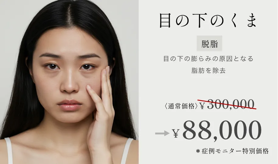 目の下のくま ¥300,000→¥88,000~ ※症例モニター特別価格