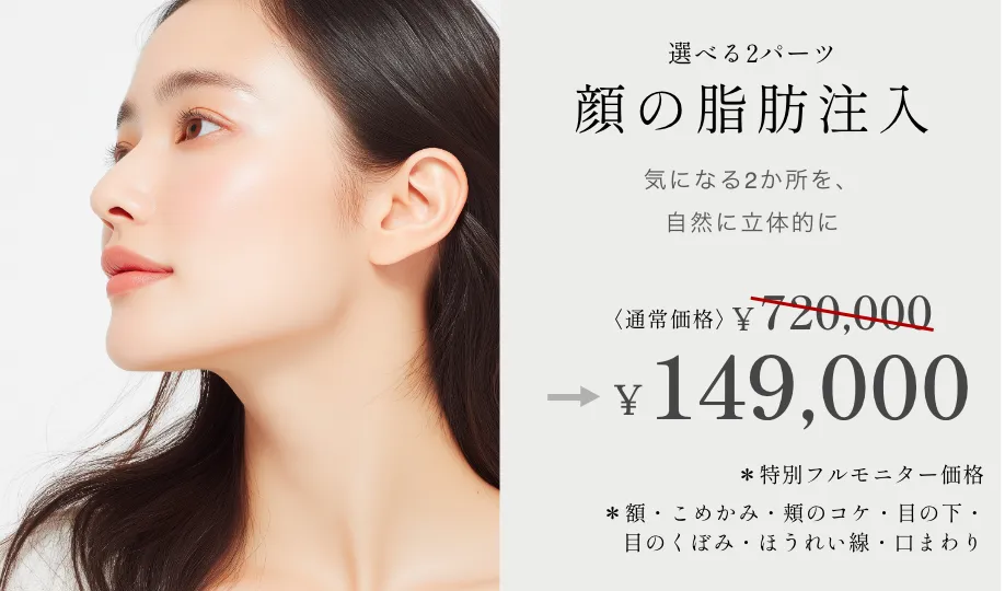 顔の脂肪注入 ¥720,000→¥149,000~ ※特別フルモニター価格