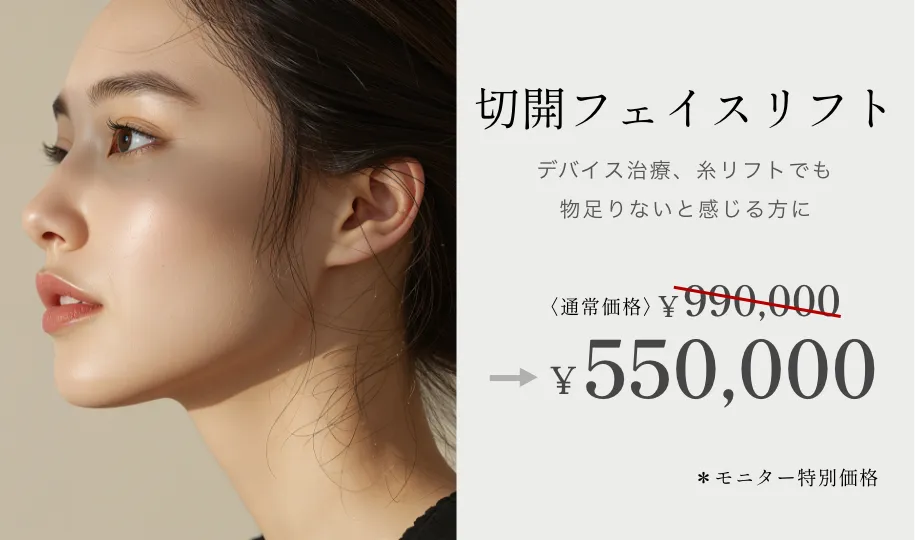 切開フェイスリフト ¥990,000→¥550,000 ※特別モニター価格