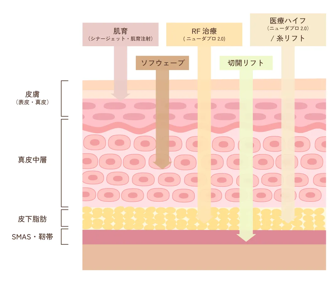 皮膚／皮下脂肪／SMAS・靭帯／骨 の多層構造