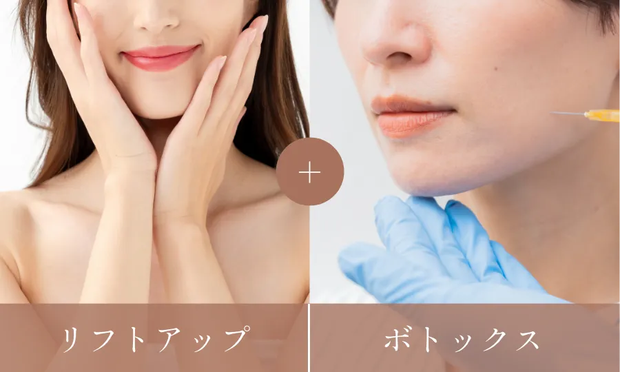 リフトアップ+ボトックス