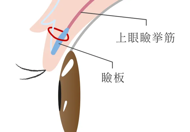 挙筋法