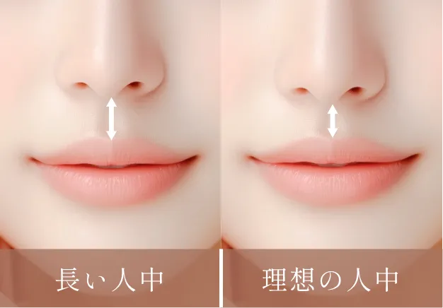 人中短縮術
